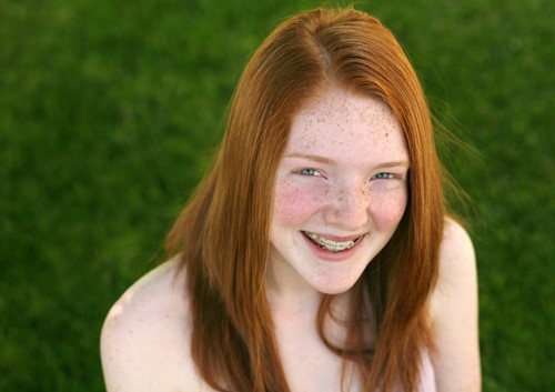 a young girl with red hair, freckles, and braces smiling